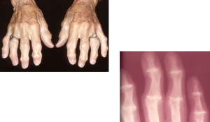 Dr. Keefe, Keefe Clinic. Tulsa Chiropractor, pain, natural health care.