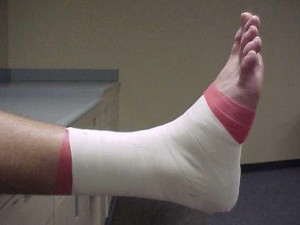 Athletic Tape ankle, Dr Keefe,  Natural Health care, pain, Tulsa chiropractor,