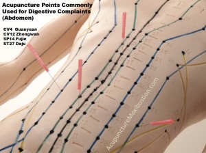 acupuncture, Dr Keefe,  Natural Health care, pain, Tulsa chiropractor,