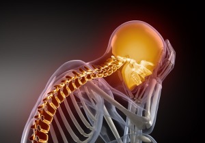 headachespine, Dr. Keefe, Natural Health care, pain, Tulsa chiropractor, neck pain, Dr. Keefe, Natural Health care, pain, Tulsa chiropractor, neck pain, headache,,