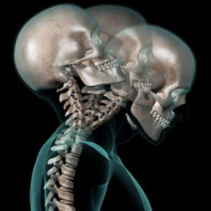 Dr. Keefe, Natural Health care, pain, Tulsa chiropractor, neck pain, headache,