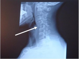 Dr. Keefe, Natural Health care, pain, Tulsa chiropractor, neck pain, headache,