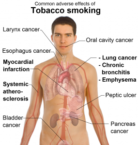 smoking effects, Dr Keefe,  Natural Health care, pain, Tulsa chiropractor,