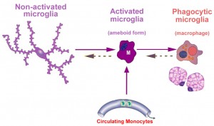 microglial activation3wDr. Keefe, Keefe Clinic. Tulsa Chiropractor, pain, natural health care.