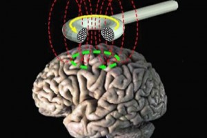 magnetic brain pulseDr. Keefe, Keefe Clinic. Tulsa Chiropractor, pain, natural health care.