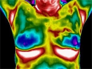 thermographyDr. Keefe, Keefe Clinic. Tulsa Chiropractor, pain, natural health care.